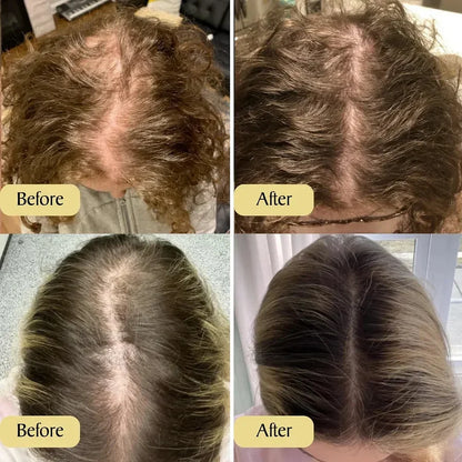 [NEW] Deoxyribose Scalp Serum | Korean Hair Care