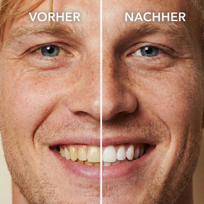 Tooth Polish - Instant Clean Smile